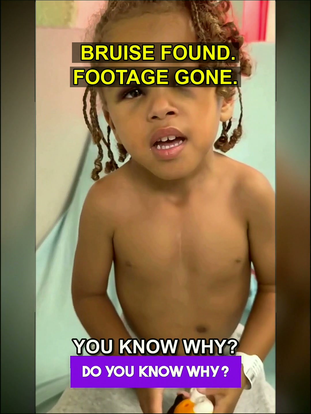 The Unedited Truth: A Mother's Fight for Answers After a Daycare Bruise and a Bizarre Case of Missing Footage